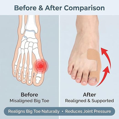 60PCS Pre‑Cut Bunion Corrector Kinesiology Tape– Elastic, Breathable & - Image 3
